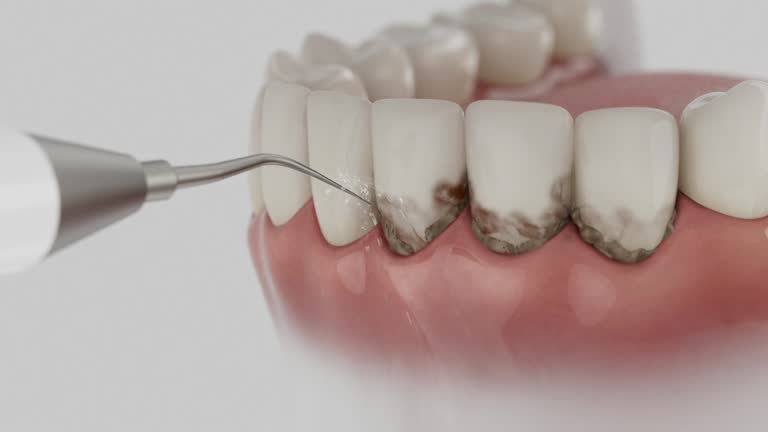 Reliable Dental Implants contractor in Floresville, TX by Smile Center Dentistry